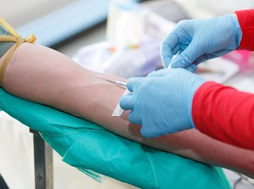 Darování krevní plazmy po dovolené: Rizika a možnosti darování